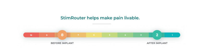 Clinical Data – StimRouter